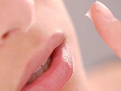 Как лечить заеды на губах
