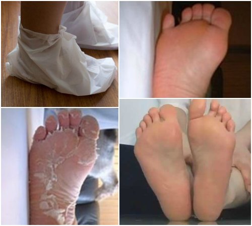 Как пользоваться одноразовыми корейскими носочками для педикюра