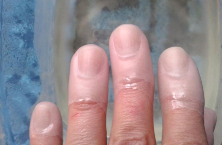 Парафинотерапия для ногтей